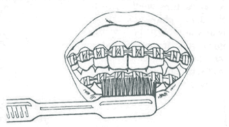 Brushing step 4