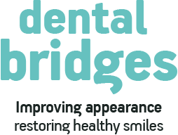 dental bridges