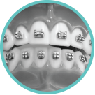 Functional orthodontic appliance