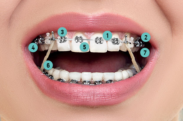 Orthodontic elastics