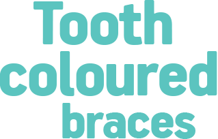 Tooth coloured braces